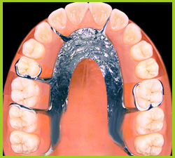 Partial or full denture. Preparing teeth.