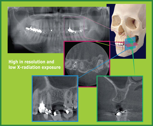 CT Diagnostic