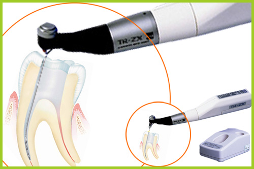 Root canal therapy and filling. Font Dental Center